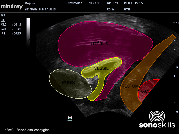 Echographie kiné : rendre visible le ressenti