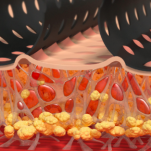 La Mécanotransduction