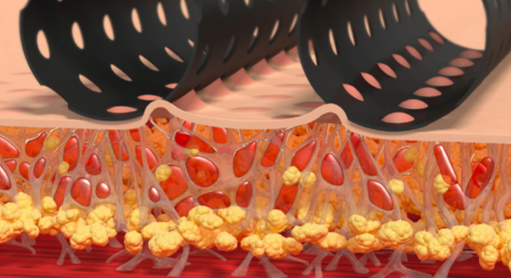 La Mécanotransduction